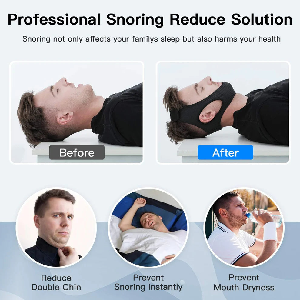 Anti Snoring Chin Strap for Sleep Apnea